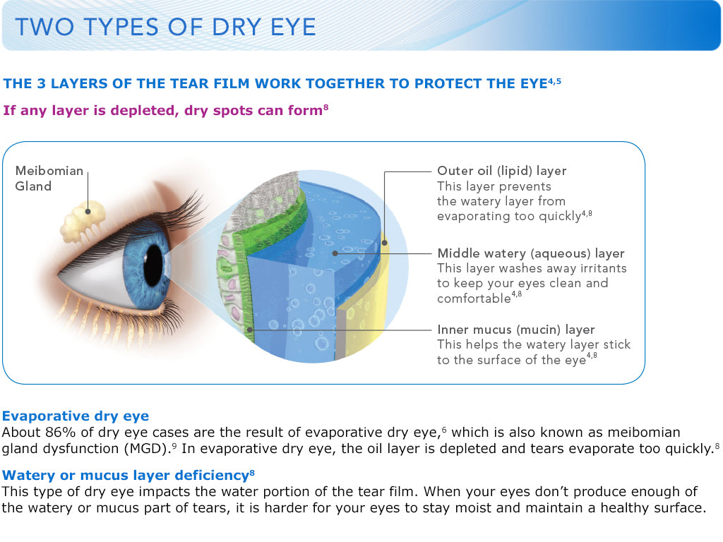Systane ULTRA Lubricant Eye Drops, 30 ml.